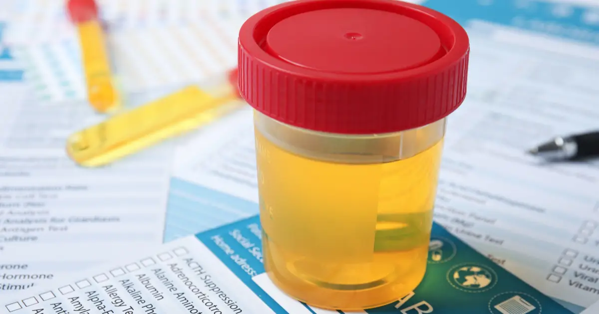 Does THCa Show Up on a Drug Test - The Truth Revealed! @ HighHippy.com